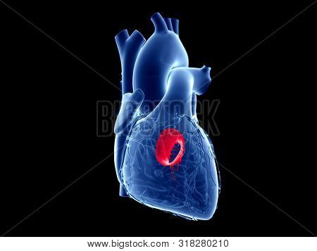 3d rendered medically accurate illustration of the mitral valve