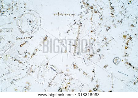 Marine Aquatic Plankton Under The Microscope View.