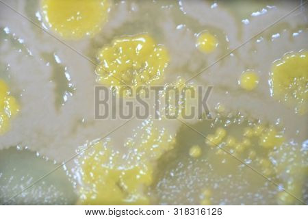 Colony Of Bacteria In Culture Medium Plate, Microbiology.