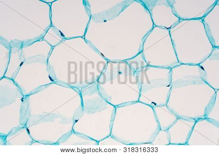 Cross Sections Of Plant Stem Under Microscope View Show Structure Of Parenchyma Cells For Education 
