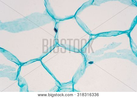Cross Sections Of Plant Stem Under Microscope View Show Structure Of Parenchyma Cells For Education 