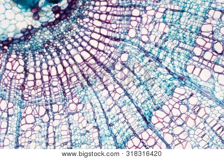 Cross Section - Xylem Is A Type Of Tissue In Vascular Plants That Transports Water And Some Nutrient