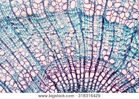 Cross Section - Xylem Is A Type Of Tissue In Vascular Plants That Transports Water And Some Nutrient