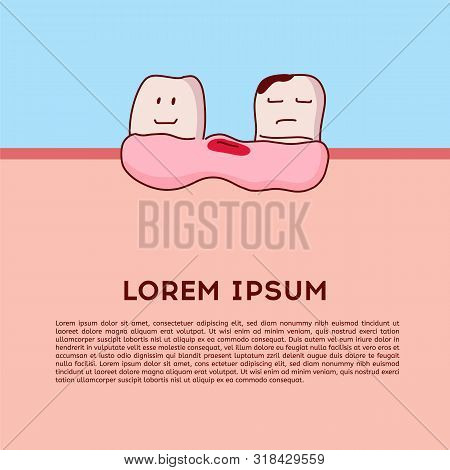 Layout Caries And Cavity Teeth Illustration Vector On Blue Background. Tooth Extraction. Dental Conc