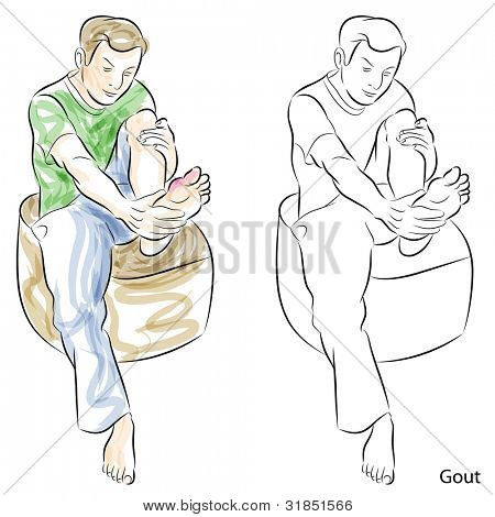 An image of a man with a hurt foot / ankle.