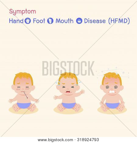 Symptom The Disease Virus Baby Children Infected Have A Blister Hand Foot Mouth Disease, Hfmd In Rai