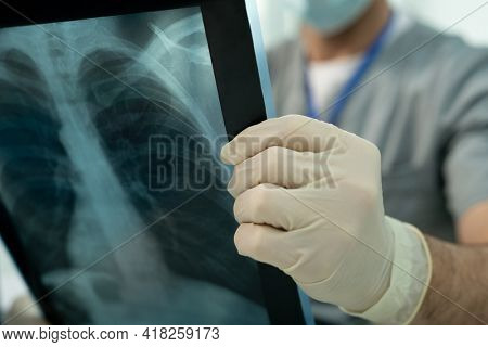 Close-up of unrecognizable doctor in gloves analyzing lung x-ray image while making diagnosis