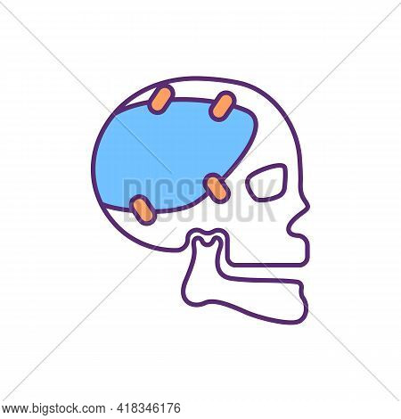 Craniofacial Prosthetic Rgb Color Icon. Reconstructive Surgery. Skull Repairment. Artificial Device.