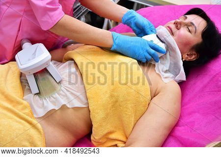 The Master Carries Out The Cryolipolysis Procedure In The Beauty Salon. Body Shaping, Reduction Of B