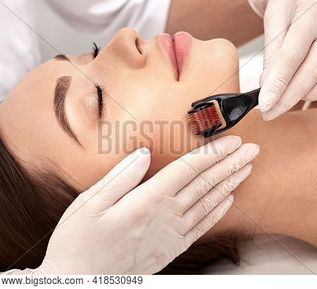 Micro Derma Facial Roller. Brunette Woman Having Derma Roller Treatment For Improving Surface Skin