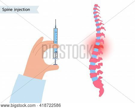 Spine Joint Injection. Pain And Inflammation In The Vertebra. Spinal Arthritis Disease Concept. Medi