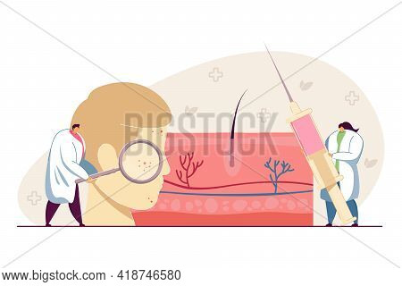 Tiny Dermatologists Examining Facial Skin. Doctors Treating Inflammation, Huge Face Flat Vector Illu