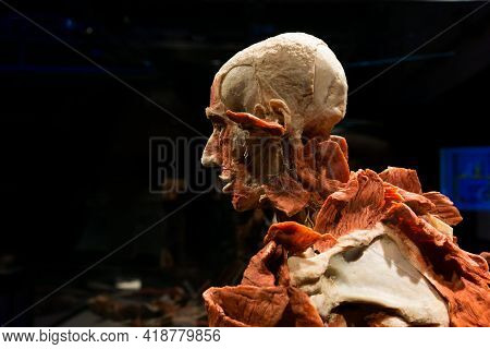 Moscow, Russia - April 16, 2021: Plastinated Human Body From The Exhibition Body Worlds