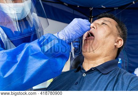 Mature Asian Man Doing Covid 19 Pcr Swab Test Through The Throat