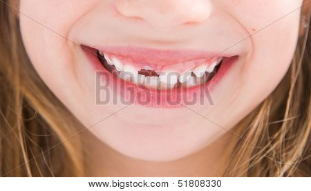 little girl without one tooth smiles close-up