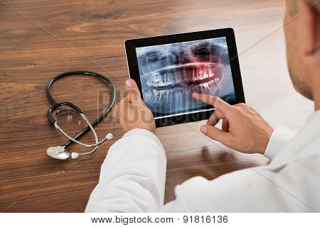 Doctor Looking At Human Teeth X-ray