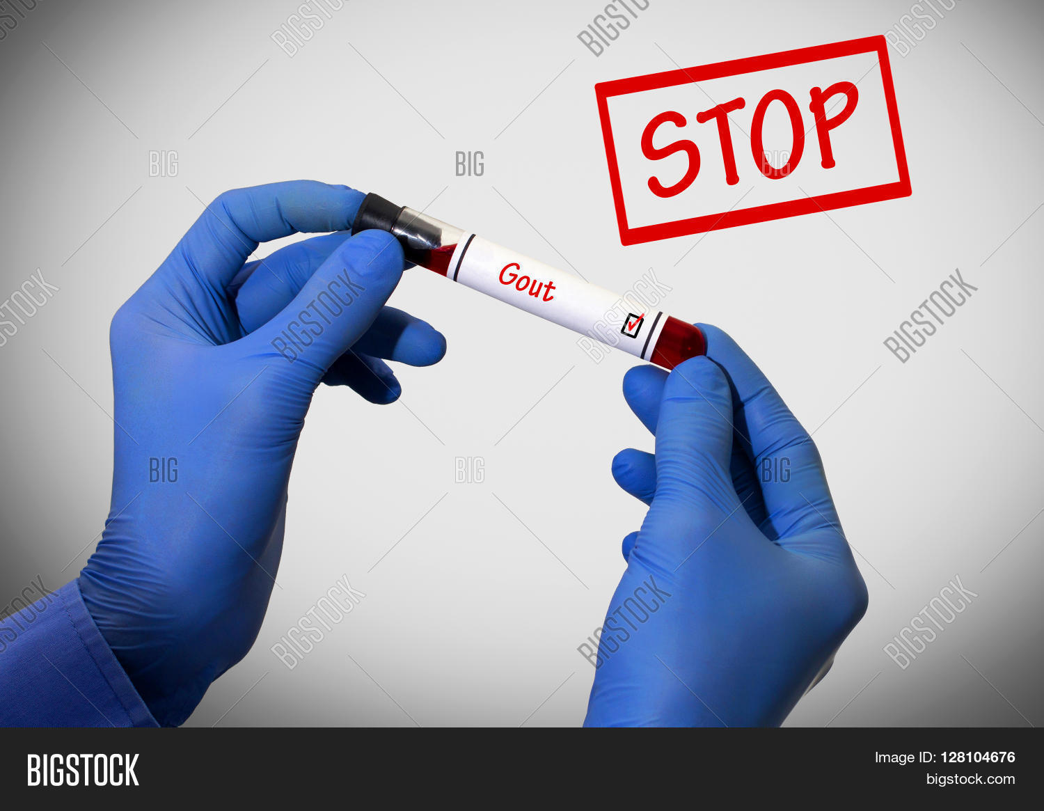 Stop Gout. Positive Image & Photo (Free Trial) Bigstock