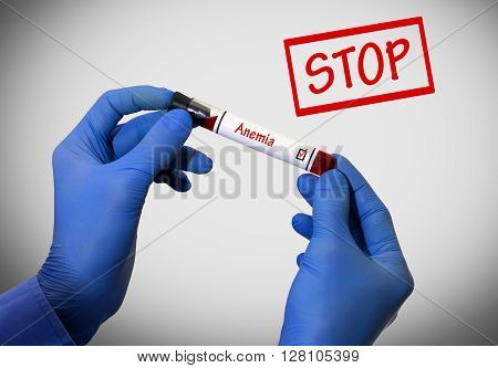 Stop anemia. Positive result of blood test. Test tube with a blood test in the doctor's hands. Medical concept.