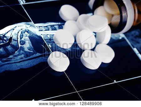 Medical concept of diagnosis and treatment of gynecological diseases.