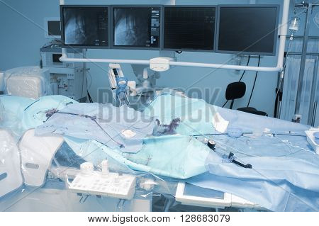 Equipment and tools in the x-ray operating (cathlab). The real situation