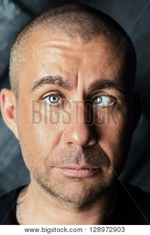 A man with strabismus. Orthoptics.