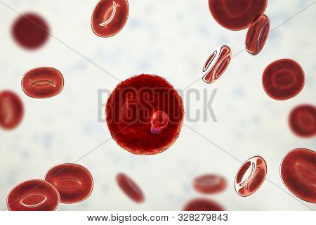 The Malaria-infected Red Blood Cell. 3d Illustration Showing Parasite Plasmodium Malariae In The Sta