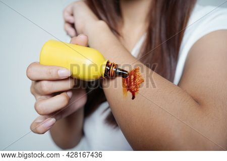 Beautiful Young Woman Applying Medicine To Yuang's Injured Hand Closeup Angle And Clean Background