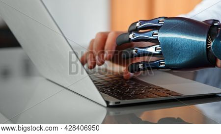 Programmer man hands with artificial bio prothesis type on laptop keyboard on table under bright sunlight in office extreme closeup