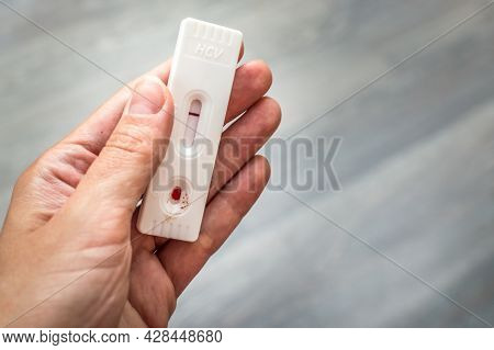Woman Holds A Test For Hepatitis C In Her Hands. Express Test At Home