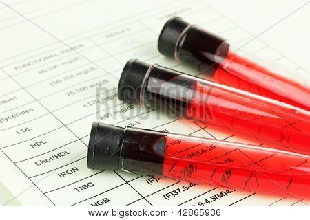 Sangue in provette e risultati close up