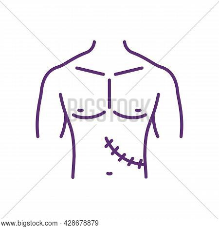 Removed Organ Aftermath Rgb Color Icon. Surgery Recovery. Illicit Organ Transplant Surgery. Body Par