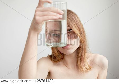 Woman With Melasma Holding Glass Of Water