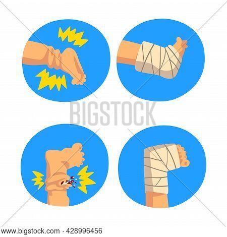 First Aid For Wounded Leg In Blue Circle Vector Set