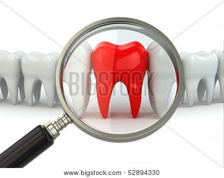 Search aching tooth in row of healthy teeth. 3d