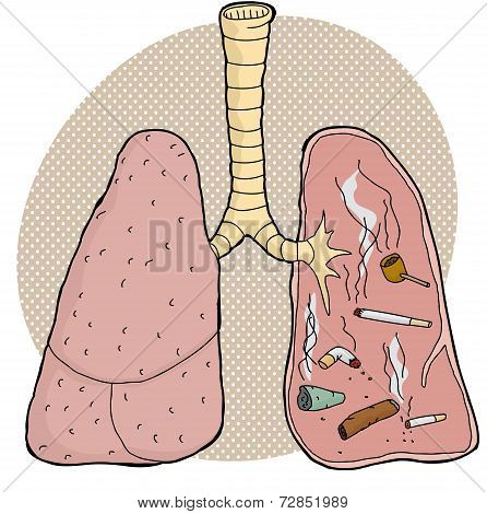 Tobacco Inside Lungs