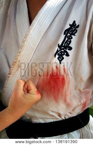 Alushta Ukraine - June 27. 2008: Blood stained uniform of the member of the international karate summer training camp.