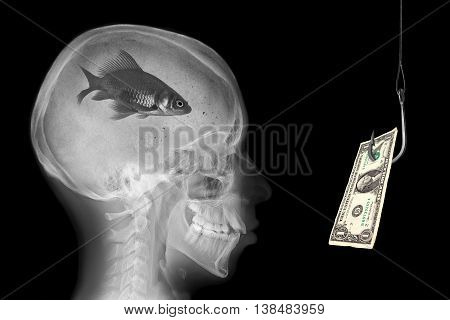 Radiography of skull with fish in the brain