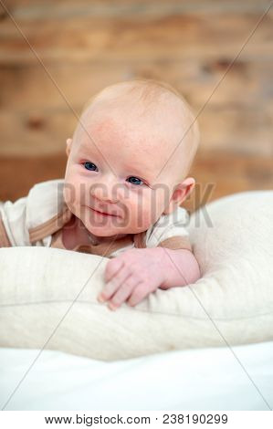 Smiling Newborn With A Rash On The Face