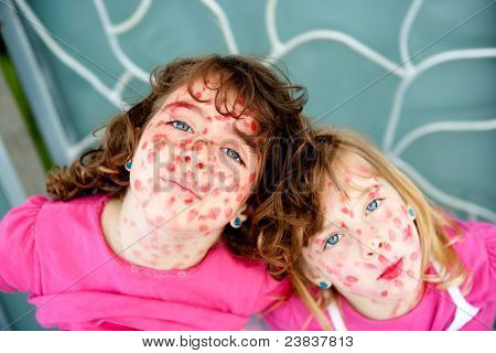 Kind Schwester Mädchen Unfug mit Mutter Lippenstift bemalt Gesicht tat Masern