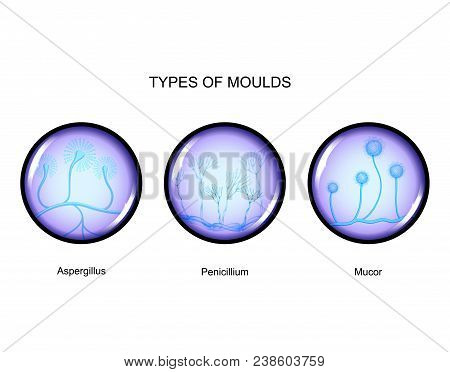 Vector Illustration Of The Types Of Mold