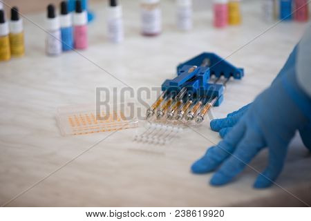 Blood Test.laboratory Of Blood.microbiological Examination Of Blood