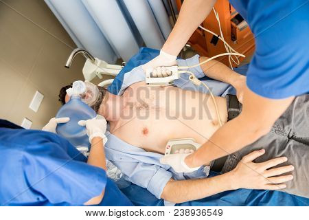 Closeup Of Doctors Performing Cpr With A Defibrillator And Ambu Bag On A Critical Male Patient In Em