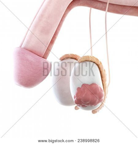 3d rendered, medically accurate illustration of testicle cancer