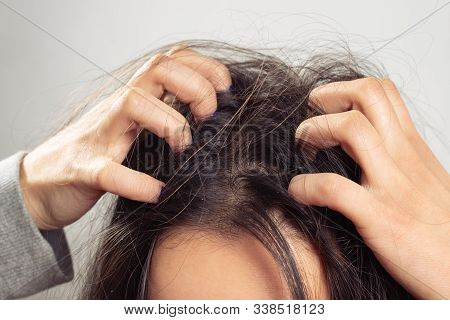 A Young Woman Scratches Her Scalp And Hair With Her Fingers. Hair Health Concept, Scalp And Hair Car
