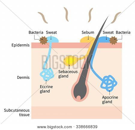 Diagram Of Body Odor And Sweat Glands. Human Skin Layer Illustration For Medical And Health Care Use