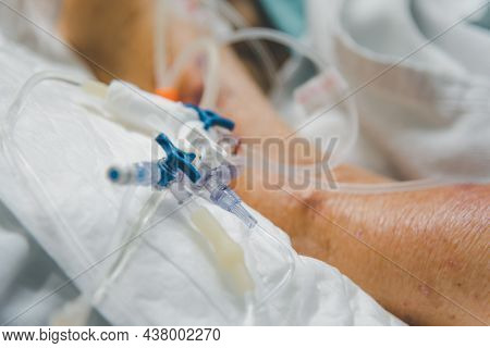 Patient Do Tracheostomy And Ventilator In Hospital