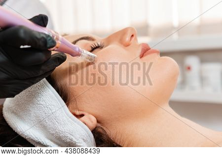Salon Cosmetology. Cosmetologist In Protective Gloves Does Procedure Of Apparatus Fractional Mesothe