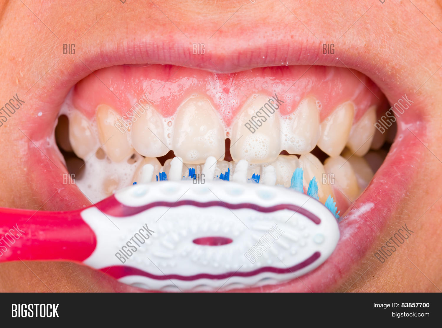 Image Preview