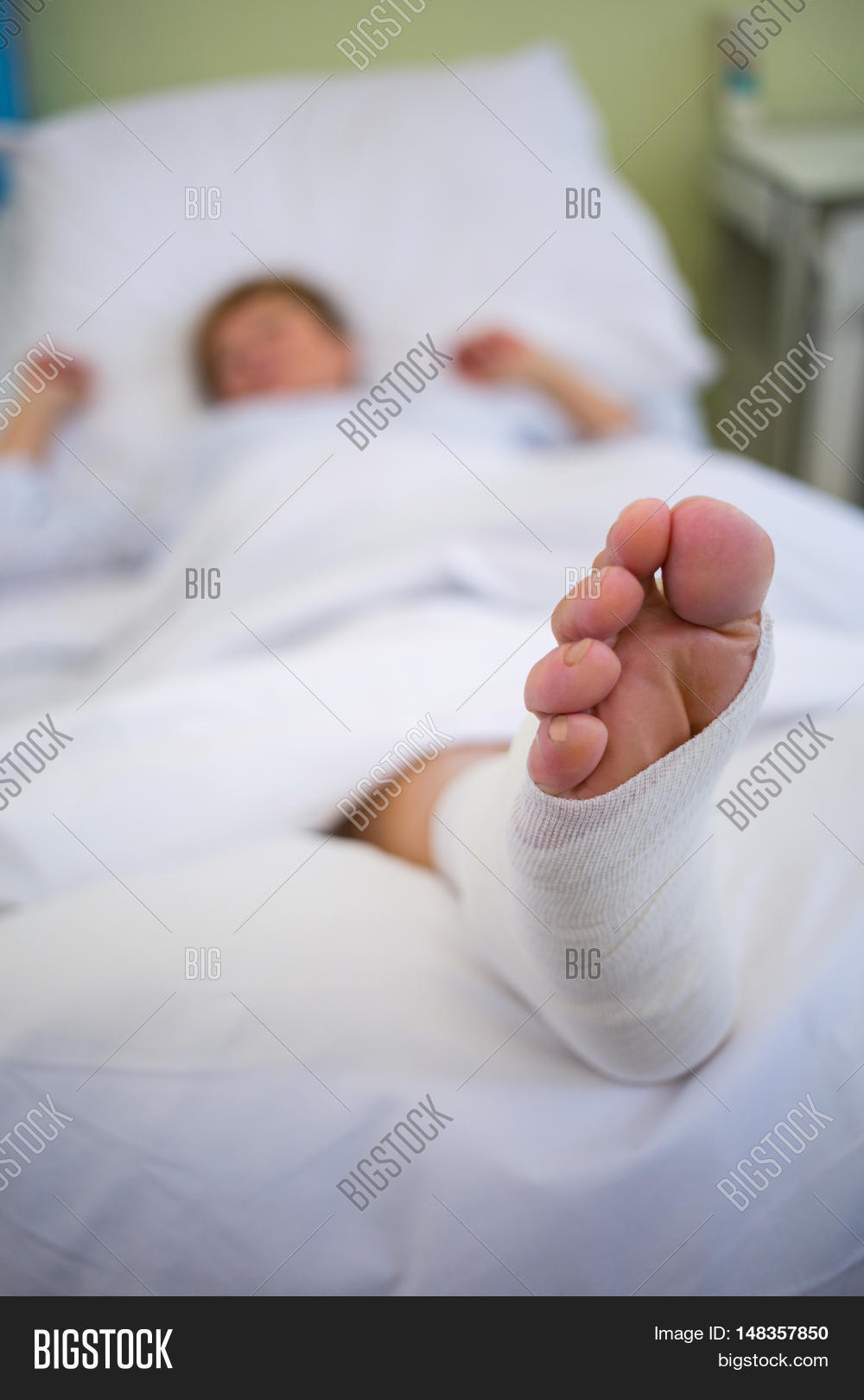 Patient Broken Leg Image \u0026 Photo (Free Trial) | Bigstock, image size:1000x1620