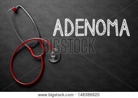 Medical Concept: Adenoma - Medical Concept on Black Chalkboard. Medical Concept: Adenoma -  Black Chalkboard with Hand Drawn Text and Red Stethoscope. Top View. 3D Rendering.